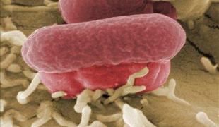 V Nemčiji novi smrtni žrtvi zaradi bakterije Ehec