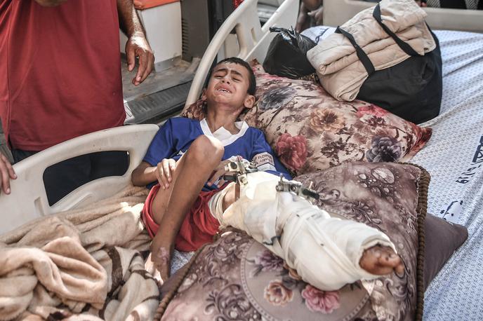 Gaza, bolnišnice, prehod Rafa | Generalni direktor WHO Tedros Adhanom Ghebreyesus je na isti novinarski konferenci dejal, da razmer v bolnišnicah na območju Gaze ni mogoče opisati z besedami. "Prenatrpane so z ranjenimi, ki ležijo na hodnikih, mrtvašnice so preobremenjene, kirurgi izvajajo operacije brez anestezije," je dejal. "Medtem ko zdravstvene potrebe naraščajo, se naše zmožnosti za njihovo zadovoljevanje zmanjšujejo," je opozoril. | Foto Reuters