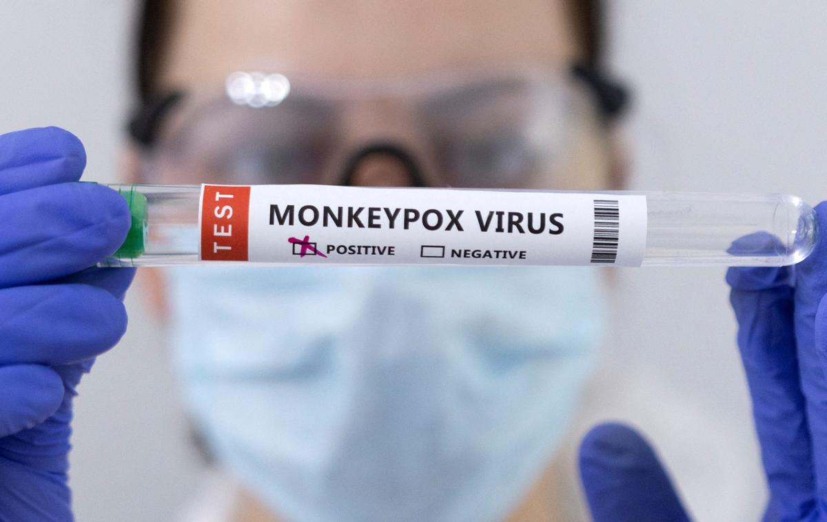 Opičje koze | Bolezen opičjih koz je tako bistveno manj prenosljiva kot covid-19, poleg tega je oseba kužna šele po pojavu simptomov, podobnim gripi, in izpuščaja. | Foto Reuters