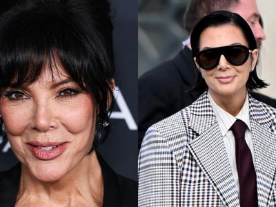 Je opevani dvig obraza Kris Jenner res že popustil?