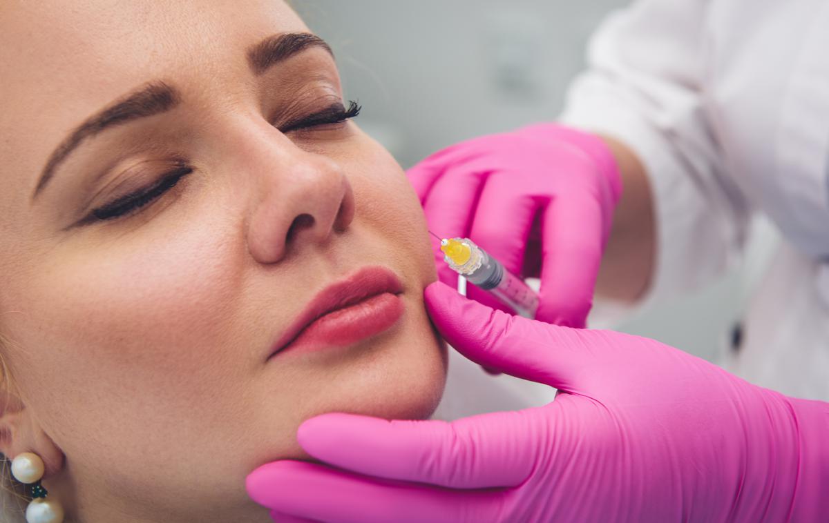 Estetski poseg | Najnevarnejši stranski učinki, ki nastanejo zaradi nepravilnega apliciranja, lahko povzročijo delno ali popolno slepoto ter zapore v venah ali arterijah in odmiranje kože.  | Foto Shutterstock