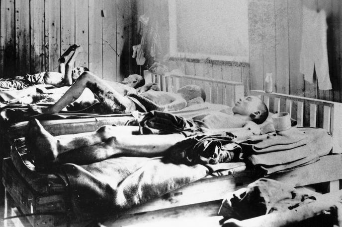 Hirošima - žrtve radioaktivnega sevanja | Atomska bomba je ubijala z visoko temperaturo, udarnim valom in radioaktivnim sevanjem. Na fotografiji iz leta 1945 vidimo žrtve atomske bombe v Hirošimi, ki trpijo zaradi posledic radioaktivnega sevanja. | Foto Guliverimage