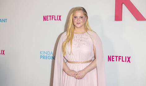 Igralka Amy Schumer šokirala z drastično spremembo videza