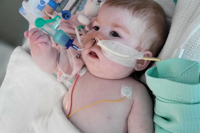 Indy Gregory, dojenčica z redko boleznijo | Foto Reuters