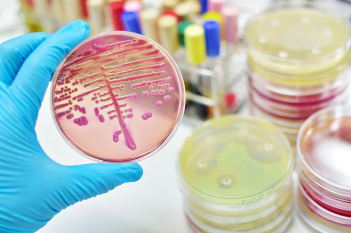 bakterije zdravila laboratorij | Antibiotiki so nas rešili posledic številnih bakterijskih okužb, a bakterije razvijajo odpornost pred njimi. | Foto Getty Images