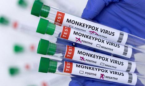 Slovenija sprejela 1.400 odmerkov cepiva zoper opičje koze