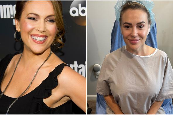 Igralka Alyssa Milano si je dala odstraniti vsadke iz prsi: Zdaj sem svobodna