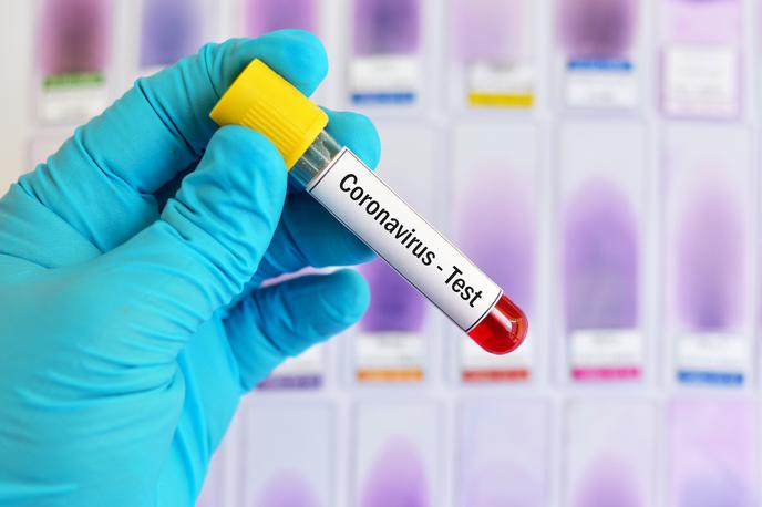 Koronavirus | O potrjenih primerih okuženih z novim koronavirusom poročajo že iz 110 držav. | Foto Getty Images