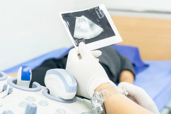 Določena stanja je mogoče zdraviti že pri plodu v maternici, zato obstaja veliko načinov ugotavljanja nepravilnosti in bolezni v maternici.  | Foto: Shutterstock