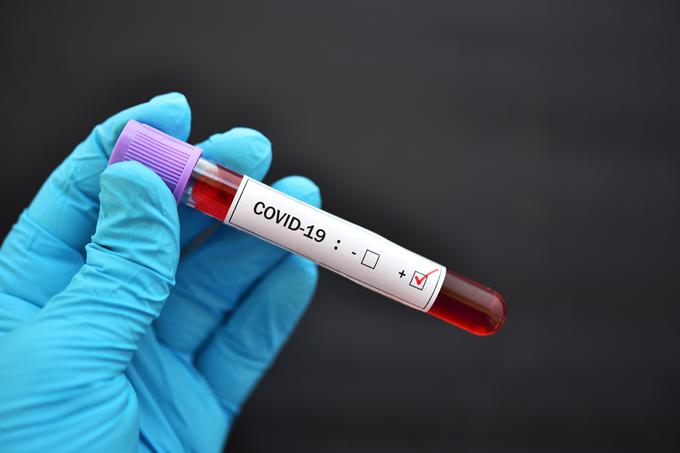 Koronavirus | Foto: Getty Images