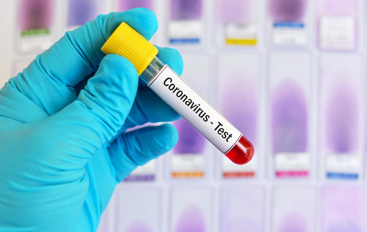 Koronavirus | O potrjenih primerih okuženih z novim koronavirusom poročajo že iz 110 držav. | Foto Getty Images