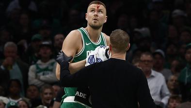 V NBA je tekla kri, a se je Kristaps Porzingis le smejal #video