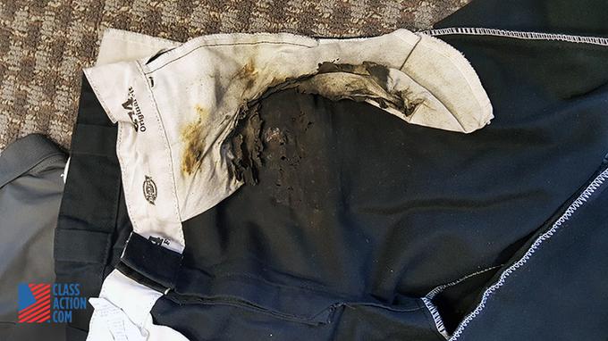 "Pečene" hlače Daniela Ramireza. Ker so bile izdelane iz poliestra, so se goreče hlače malce stopile in sprijele s kožo nesrečnega uporabnika Samsunga Galaxy S7 edge. | Foto: ClassAction.com