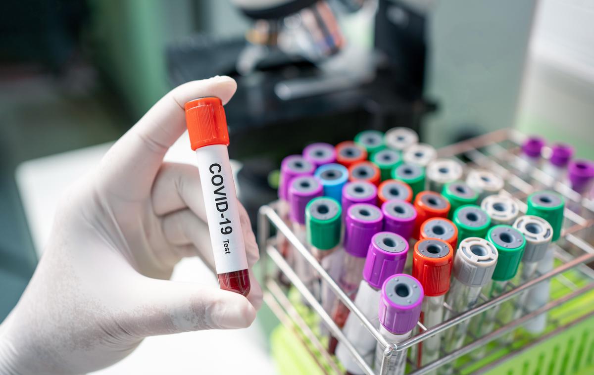 Covid. Koronavirus. Testiranje. Korona. Covid-19 | Število aktivnih primerov okužbe je v primerjavi s prejšnjim dnem spet naraslo. | Foto Shutterstock