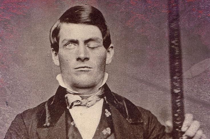 Phineas Gage. | Foto: Wikimedia Commons