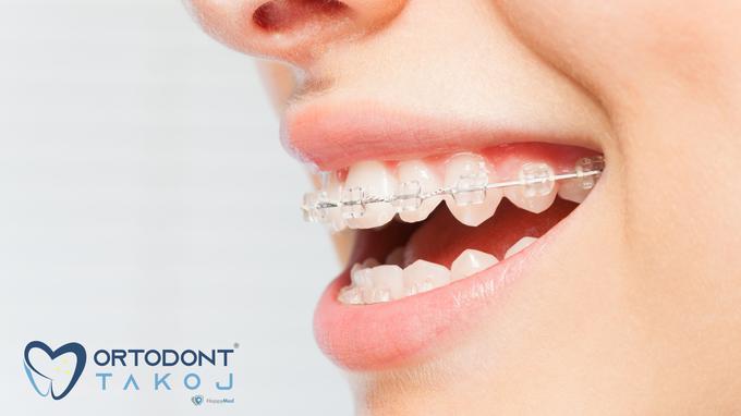 ORTODONT TAKOJ® omogoča ortodonta za otroka brez čakalne dobe in s povračilom stroškov zdravljenja na napotnico prek spletne strani. Prijava z napotnico je na voljo na povezavi OBRAZEC ZA NAROČANJE. | Foto: 