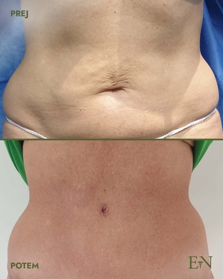 Lepotni poseg | Foto: Dr. Ernest Novak