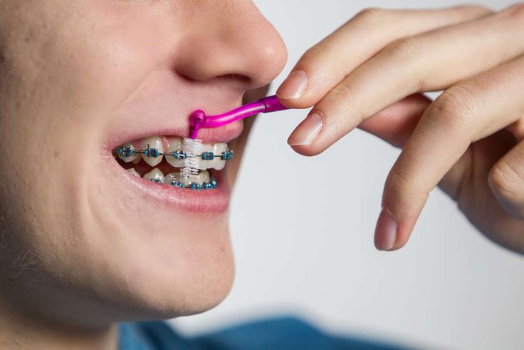 Medzobne ščetke so nepogrešljiv pripomoček za čiščenje medzobnih prostorov ter nosilcev in žičk zobnega aparata. | Foto: ortho - CPS
