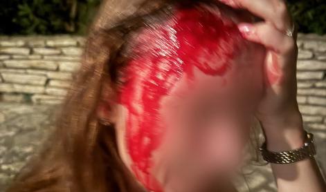 To je poškodba dekleta, ki so jo brutalno napadli varnostniki #video