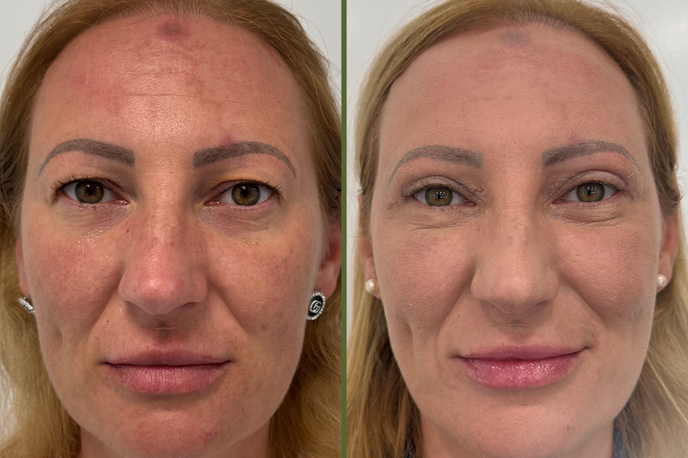 ernest novak lepotni posegi | Foto Dr. Ernest Novak