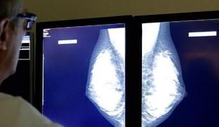 Rak dojke ima visoko stopnjo ozdravljivosti