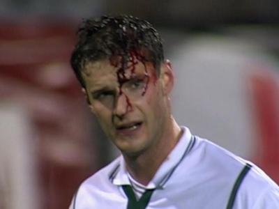 Življenjska pot Muamerja Vugdalića, ki je junaško krvavel za Slovenijo