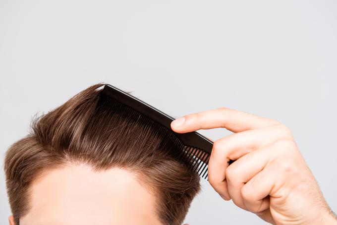 moški lasje šampon | Foto: Getty Images