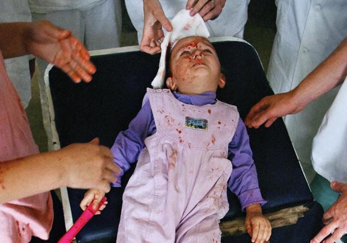 Fotografija je bila posnetka 1. avgusta 1995 po raketnem napadu na Sarajevo. Otrok na fotografiji je v UKC Sarajevo, kjer so mu poskušali rešiti življenje zaradi šrapnela, ki mu je priletel v glavo po napadu. | Foto: Guliverimage/Vladimir Fedorenko