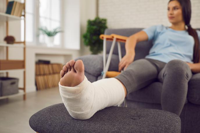 poškodba zvin mavec | Foto Shutterstock