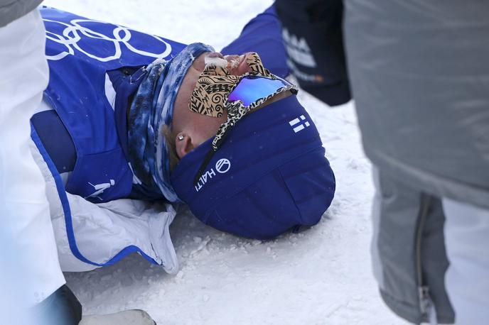 Remi Lindholm | Finski smučarski tekač Remi Lindholm se na nedeljski kraljevski preizkušnji v smučarskem teku, ki je bila zaradi ekstremnega mraza in vetra s 50 skrajšana na 30 kilometrov, boril z omrzlino na skrajno občutljivem mestu.  | Foto Guliverimage