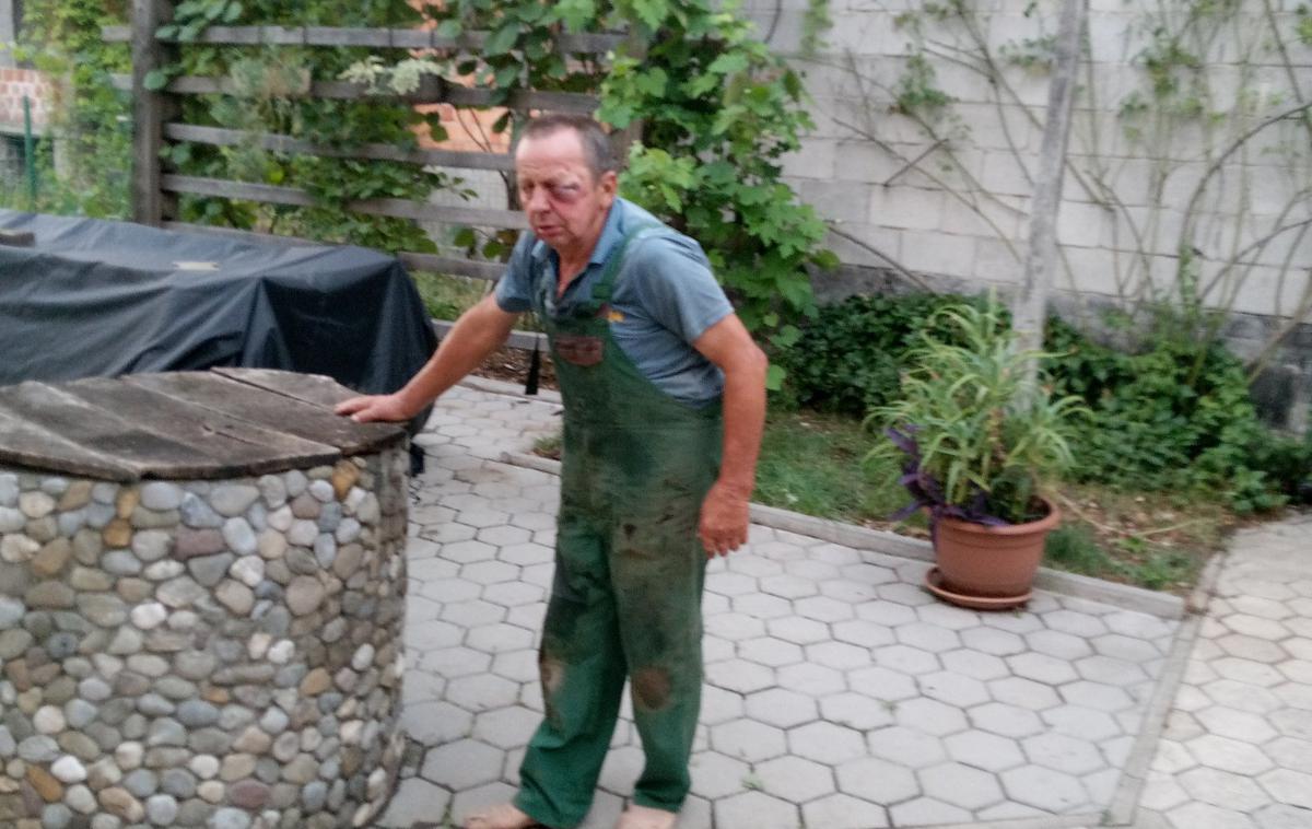 Napad Romi | Tone je v pretepu utrpel hude podpludbe očesa in počeno ličnico.  | Foto X/@LukaSvetina