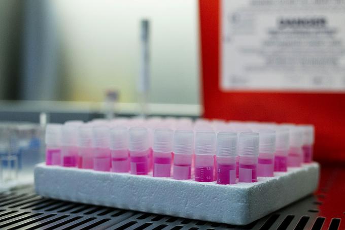 V ponedeljek je bilo ob 3.308 opravljenih testih na novi koronavirus okuženih 397 oseb.  | Foto: Ana Kovač