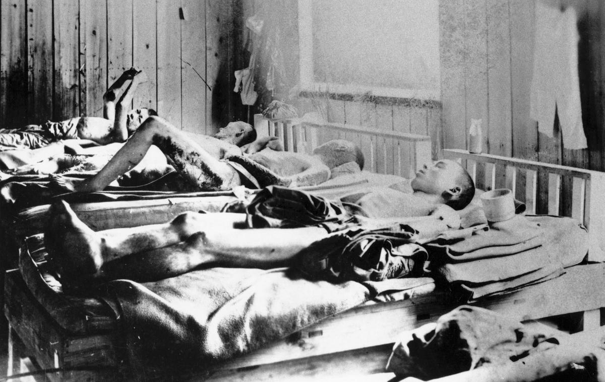 Hirošima - žrtve radioaktivnega sevanja | Atomska bomba je ubijala z visoko temperaturo, udarnim valom in radioaktivnim sevanjem. Na fotografiji iz leta 1945 vidimo žrtve atomske bombe v Hirošimi, ki trpijo zaradi posledic radioaktivnega sevanja. | Foto Guliverimage
