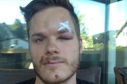 Video: Lefebvre bo zaradi brutalnega naleta počival na osmih tekmah