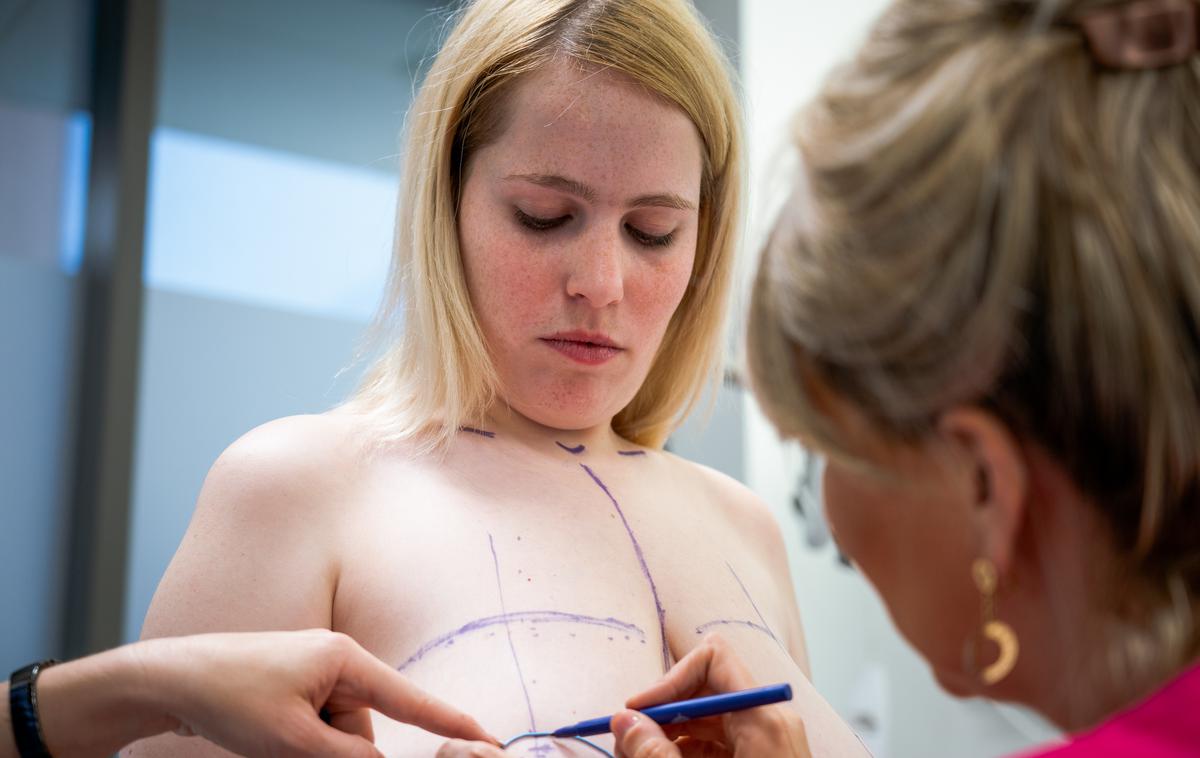 Petra Pintarič | Petra Pintarič je dočakala veliki dan in redukcijsko mamoplastiko, ki ji bo olajšala življenje. | Foto Jan Lukanović