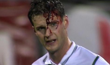 Kruto, a resnično. Vsakič, ko je udaril žogo, ga je oblila kri.