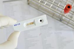 Prvi test za domače testiranje za virus HIV je na prodaj