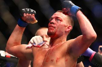 Dvoboja, ki ga vsi čakajo, očitno res ne bo