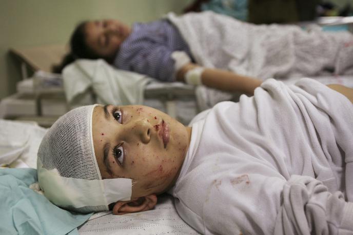 Gaza | Med žrtvami izraelskega bombardiranja Gaze so številni palestinski otroci. Več kot 15 tisoč naj bi jih bilo že ubitih, številni so ranjeni in pohabljeni. | Foto Guliverimage