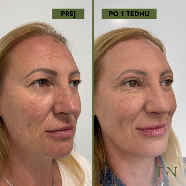ernest novak lepotni posegi | Foto: Dr. Ernest Novak