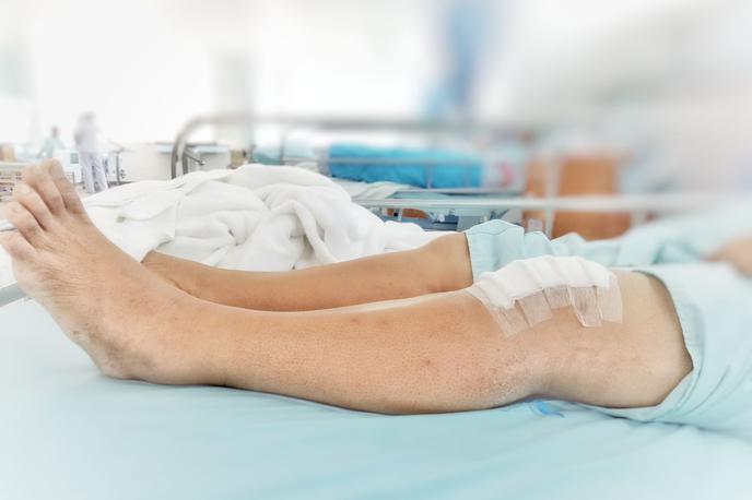 Medicofit, artroskopija kolena | Foto Medicofit