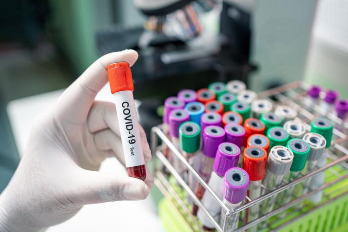 Covid. Koronavirus. Testiranje. Korona. Covid-19 | Število aktivnih primerov okužbe je v primerjavi s prejšnjim dnem spet naraslo. | Foto Shutterstock