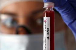 Koronavirus: to so zadnje številke okuženih v Sloveniji