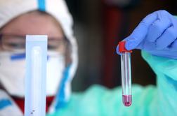 Nemški znanstveniki: Krvna skupina lahko vpliva na potek bolezni covid-19