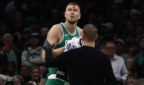 V NBA je tekla kri, a se je Kristaps Porzingis le smejal #video