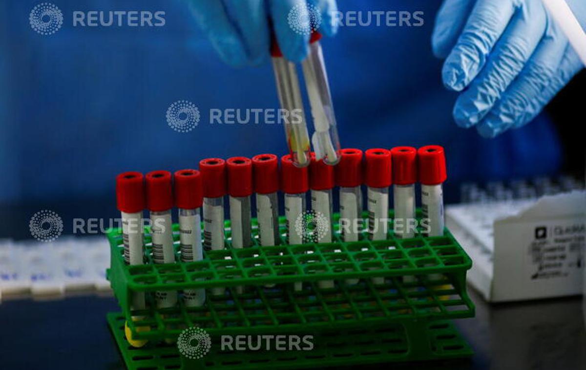 testiranje covid | Foto Reuters