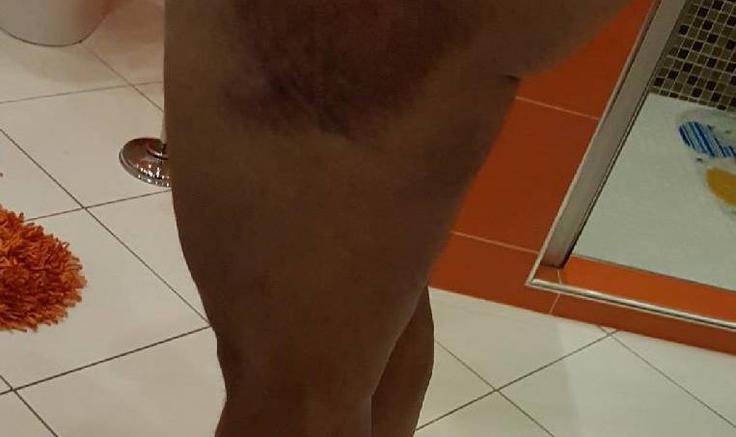 Željkov padec ni bil ravno nedolžen. | Foto: 