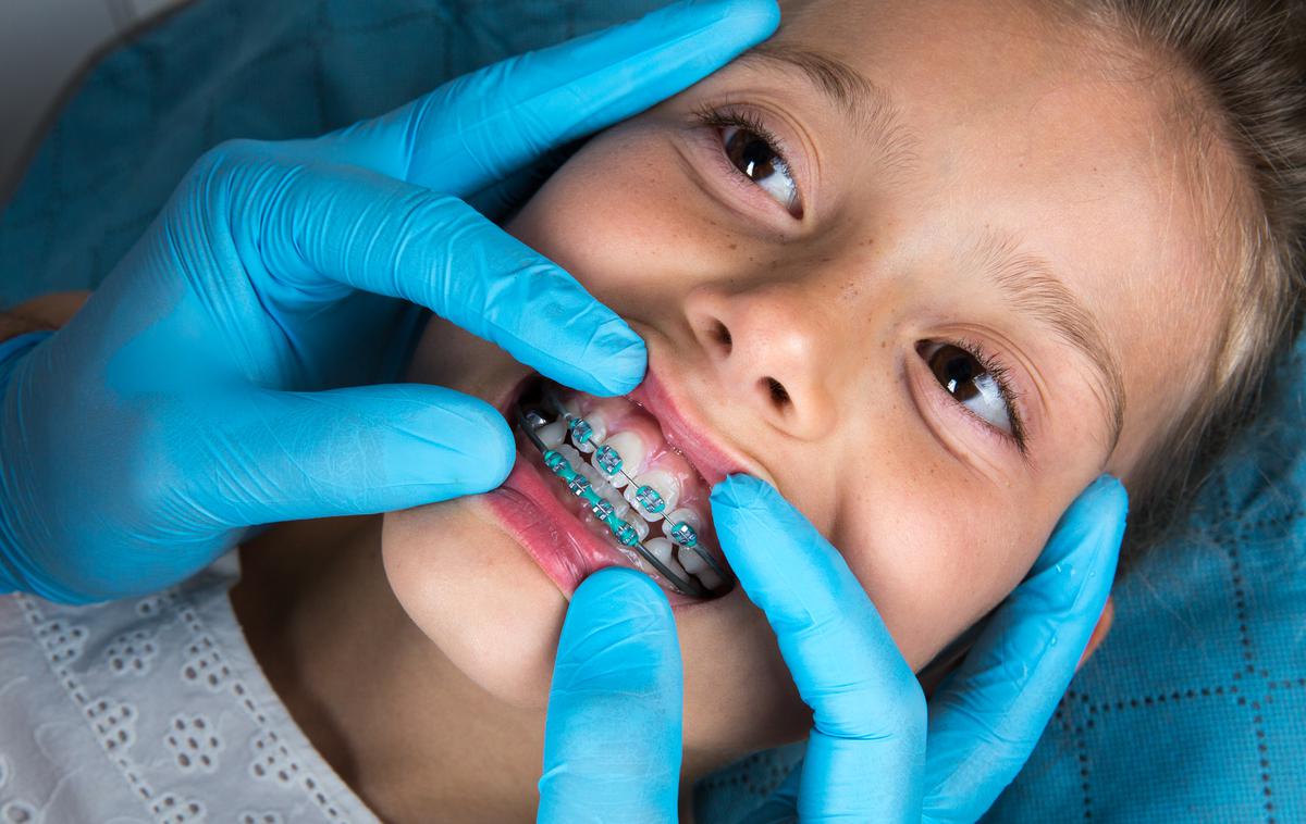 Ortodont. Zobozdravnik. Zobni aparat. | Nekateri otroci zdaj na ortodontski pregled čakajo tudi do sedem let, ortodonti pa opažajo, da je kar tretjina otrok z napotnico na ortodontski pregled tja napotena po nepotrebnem, na željo staršev. | Foto Getty Images