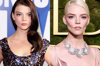 Estetski kirurg opozarja: Številni bodo ta lepotni poseg obžalovali