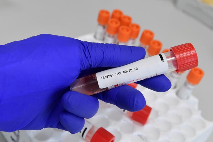 covid-19 | V četrtek so potrdili 1.336 primerov okužbe s koronavirusom. | Foto Reuters